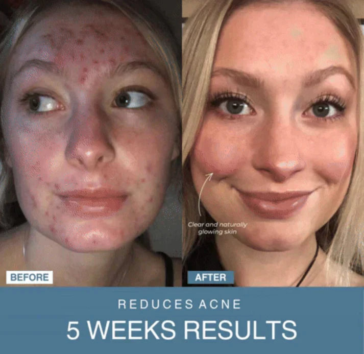 Tijarat™ 7-in-1 LED Anti-Aging/Wrinkle Apparatus